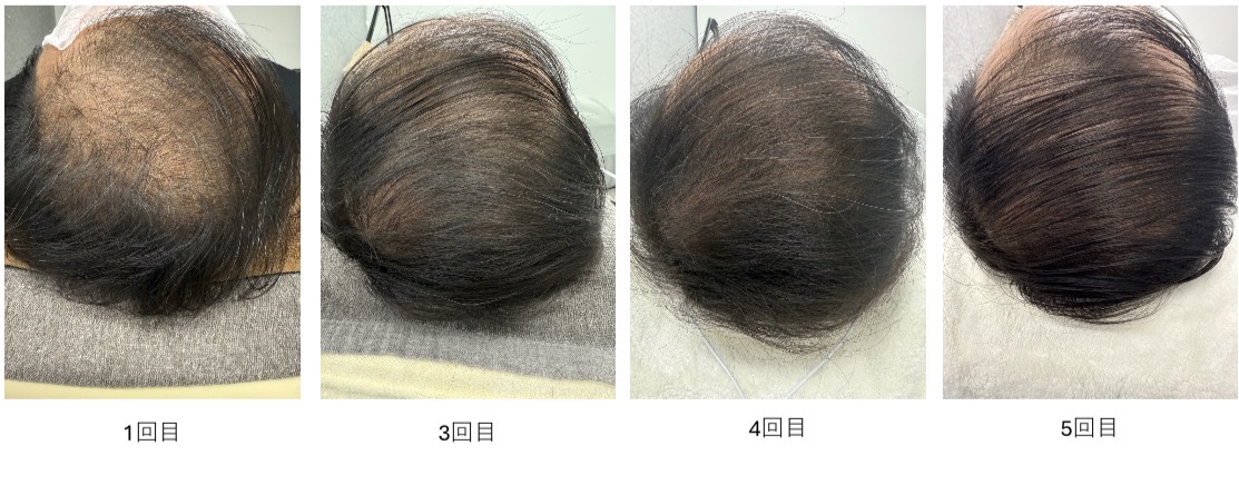 ビフォーアフター症例