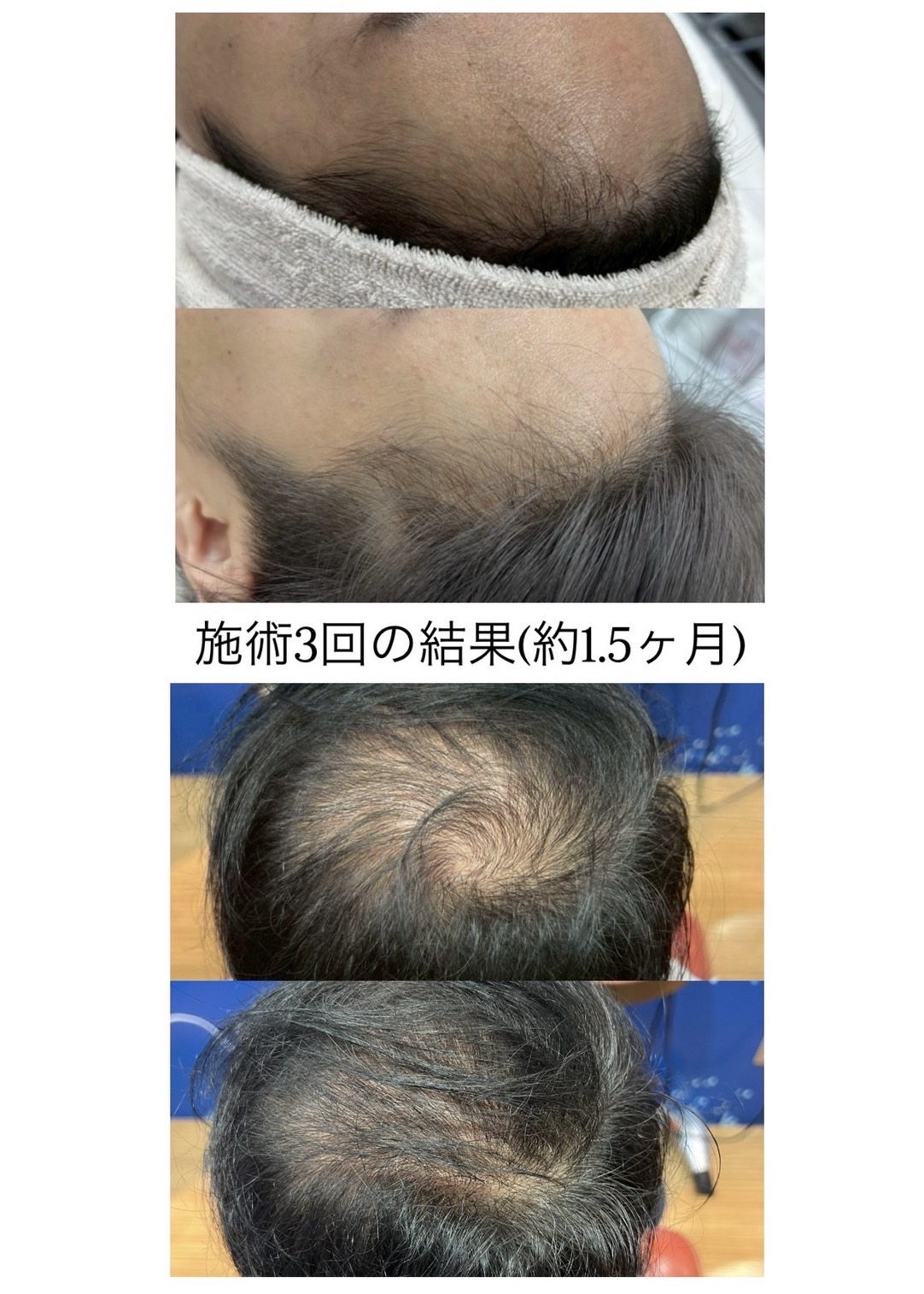 ビフォーアフター症例